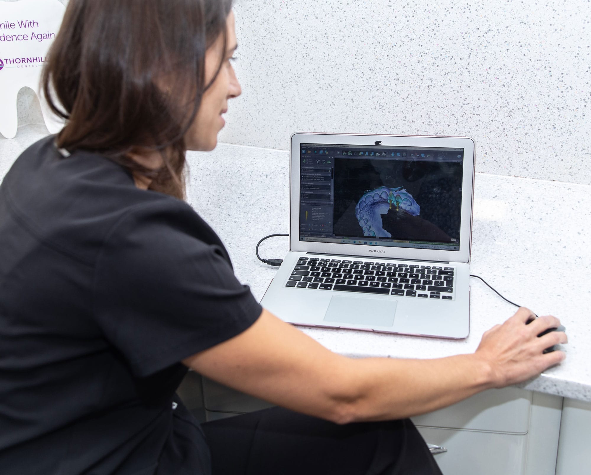 Dental implate 3d xray