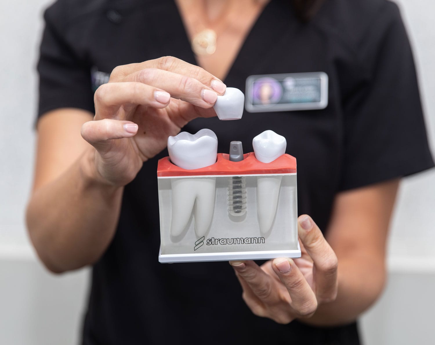 Dental impant 3d model