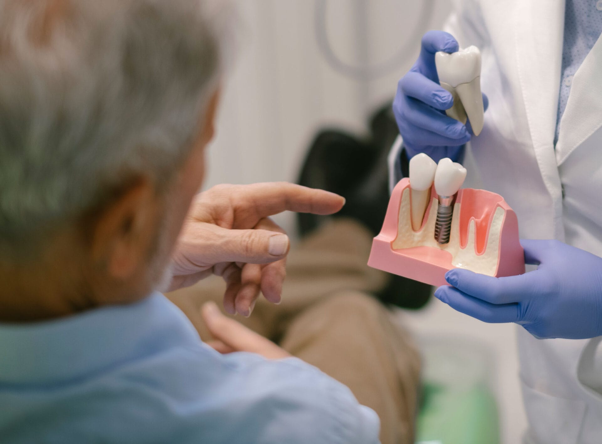 Dental implant model